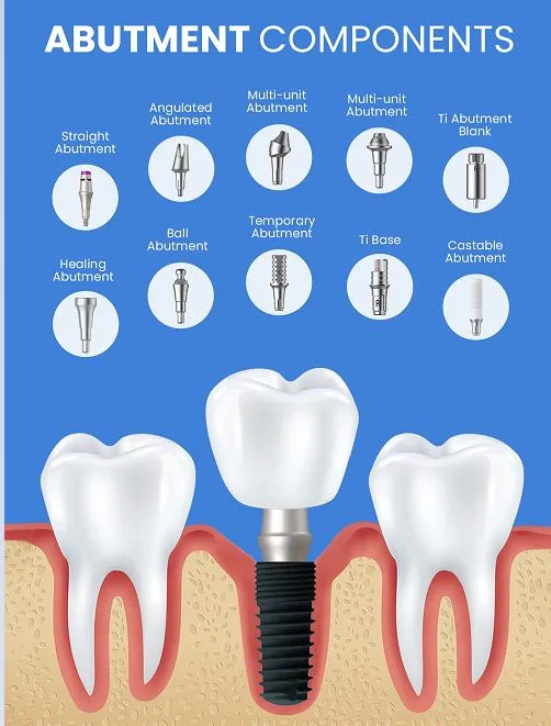 Popularity OEM Dental Implant Prosthetic Accessory Tissue Level Dental Prosthetic Components